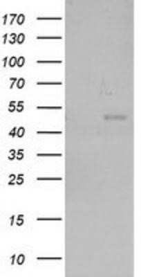 Western Blot: NEU2 Antibody (OTI4F4)Azide and BSA Free [NBP2-72944]