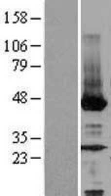 Western Blot: NEU2 Overexpression Lysate [NBL1-13595]