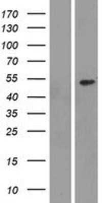 Western Blot: NEU3 Overexpression Lysate [NBP2-04315]