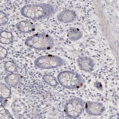 Immunohistochemistry: NEU4 Antibody [NBP2-32682]