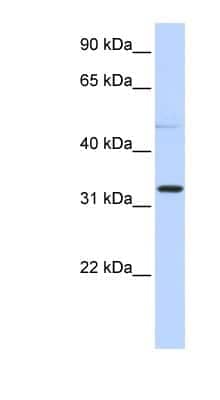 Western Blot: NEU4 Antibody [NBP1-56703]