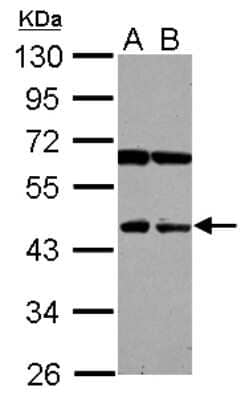 Western Blot: NEU4 Antibody [NBP2-19517]