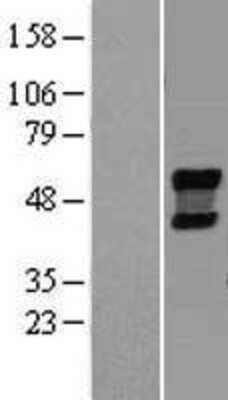 Western Blot: NEU4 Overexpression Lysate [NBL1-13597]