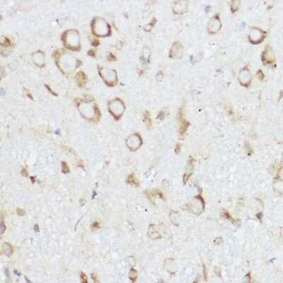 Immunohistochemistry-Paraffin: NEURL1B Antibody - Azide and BSA Free [NBP3-16021]