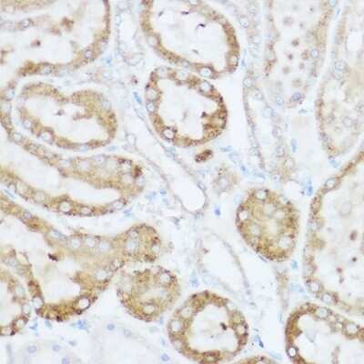 Immunohistochemistry-Paraffin: NEURL1B Antibody - Azide and BSA Free [NBP3-16021]