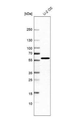 Western Blot: NEURL1B Antibody [NBP1-90499]