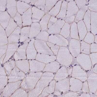 Immunohistochemistry-Paraffin: NEURL2 Antibody [NBP2-13654]