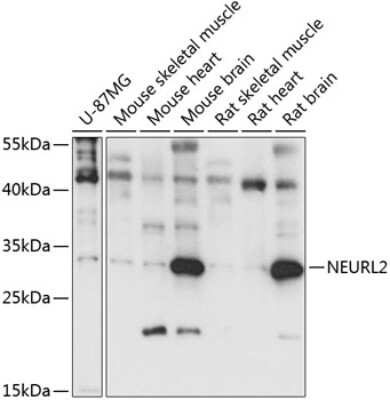 Western Blot: NEURL2 AntibodyAzide and BSA Free [NBP2-94337]