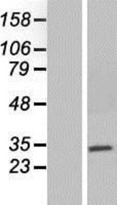 Western Blot: NEURL2 Overexpression Lysate [NBP2-05762]