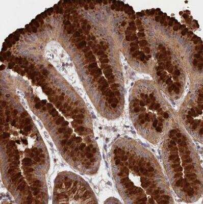 Immunohistochemistry-Paraffin: NEURL4 Antibody [NBP1-93574]