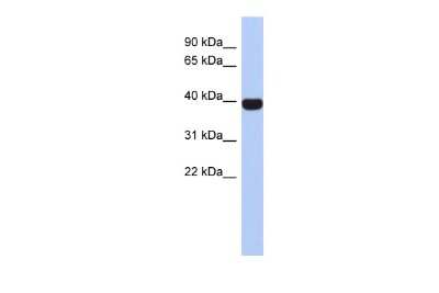 Western Blot: NEUROD4 Antibody [NBP2-87902]