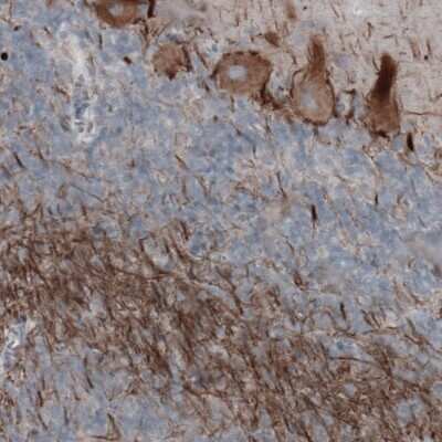 Immunohistochemistry: NF-H Antibody (CL2671) [NBP2-46615]