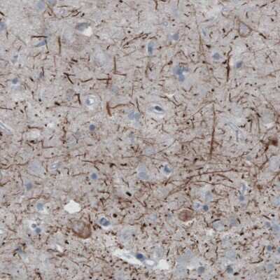 Immunohistochemistry: NF-H Antibody (CL2671) [NBP2-46615]