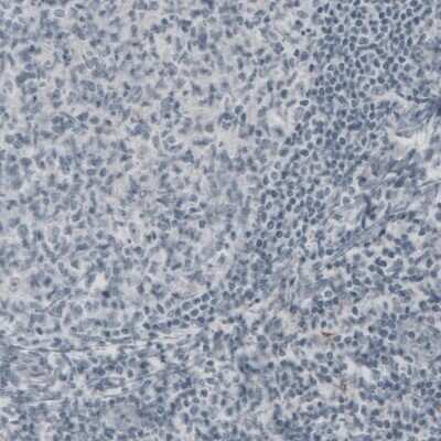 Immunohistochemistry: NF-H Antibody (CL2671) [NBP2-46615]