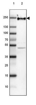 Western Blot: NF-H Antibody (CL2671) [NBP2-46615]