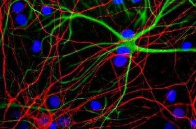 Immunocytochemistry/ Immunofluorescence: NF-H Antibody (9B12) [NBP1-05210]