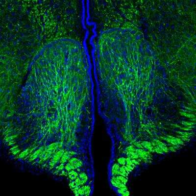 Immunohistochemistry Free-Floating: NF-H Antibody (9B12) [NBP1-05210]