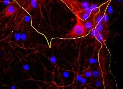 Immunocytochemistry/ Immunofluorescence: NF-H Antibody (AH1) [NBP1-05209]
