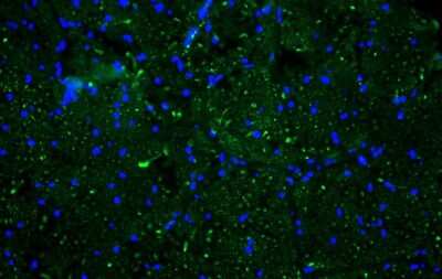 Immunocytochemistry/ Immunofluorescence: NF-H Antibody [NB300-217]