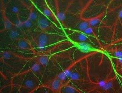 Immunocytochemistry/ Immunofluorescence: NF-H Antibody [NBP1-05215]