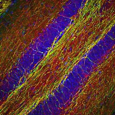 Immunohistochemistry Free-Floating: NF-H Antibody [NBP1-05215]