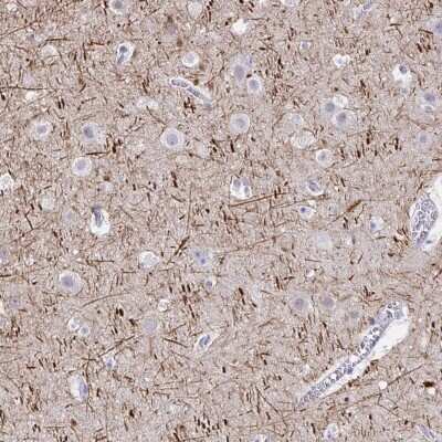 Immunohistochemistry-Paraffin: NF-H Antibody [NBP2-37984]