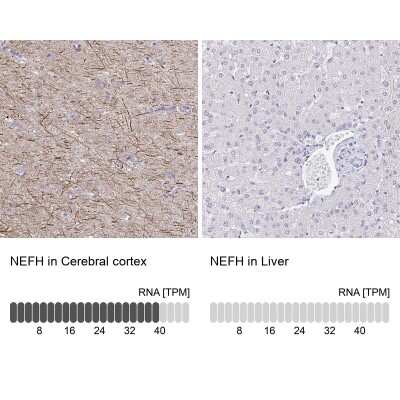 Immunohistochemistry-Paraffin: NF-H Antibody [NBP2-37984]