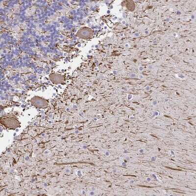 Immunohistochemistry-Paraffin: NF-H Antibody [NBP2-37984]