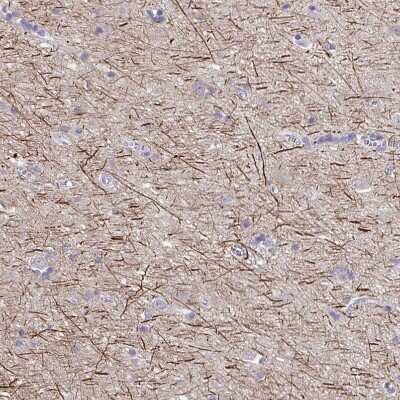 Immunohistochemistry-Paraffin: NF-H Antibody [NBP2-37984]