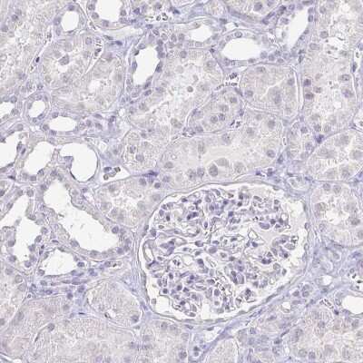 Immunohistochemistry-Paraffin: NF-H Antibody [NBP2-37984]