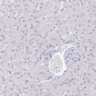 Immunohistochemistry-Paraffin: NF-H Antibody [NBP2-37984]