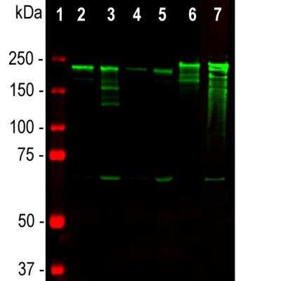 Western Blot: NF-H Antibody (NAP4) [NB300-136]