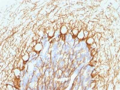 Immunohistochemistry-Paraffin: NF-H Antibody (NE14) [NBP2-44728]