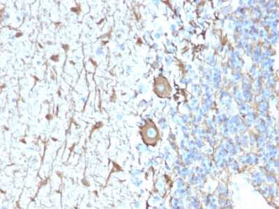 Immunohistochemistry-Paraffin: NF-H Antibody (NEFL.H/2324R) - Azide and BSA Free [NBP3-08552]