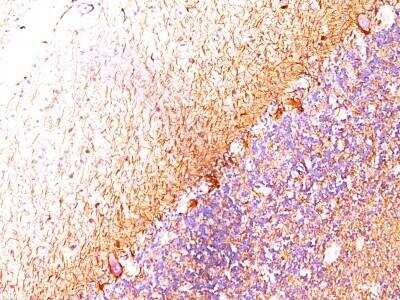 Immunohistochemistry-Paraffin: NF-H Antibody (RT-97 + NR-4) - Azide and BSA Free [NBP2-47664]