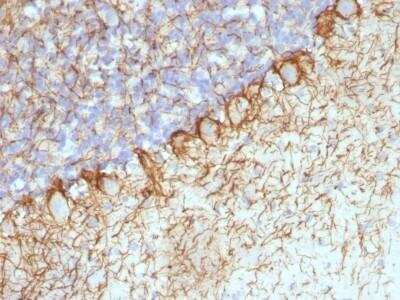 Immunohistochemistry-Paraffin: NF-H Antibody (RT-97 + NR-4) - Azide and BSA Free [NBP2-47664]