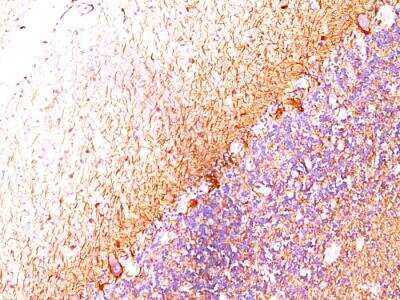 Immunohistochemistry-Paraffin: NF-H Antibody (RT-97 + NR-4) - IHC-Prediluted [NBP2-48253]