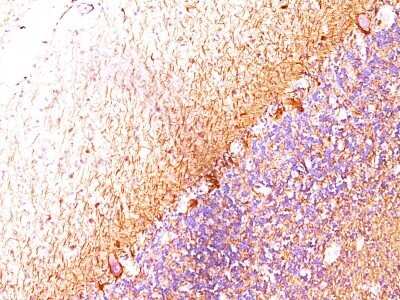 Immunohistochemistry-Paraffin: NF-H Antibody (RT-97 + NR-4) [NBP2-45280]