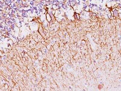 Immunohistochemistry-Paraffin: NF-H Antibody (SPM145) - Azide and BSA Free [NBP2-47668]