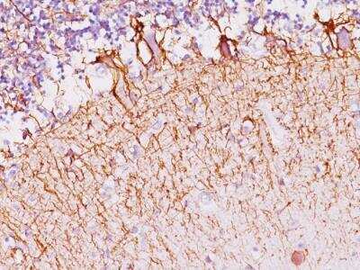 Immunohistochemistry-Paraffin: NF-H Antibody (SPM145) - IHC-Prediluted [NBP2-48291]