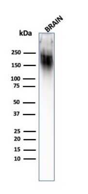 Western Blot: NF-H Antibody (SPM203)Azide and BSA Free [NBP2-47833]