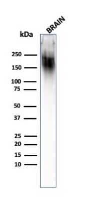 Western Blot: NF-H Antibody (SPM203) [NBP2-44727]