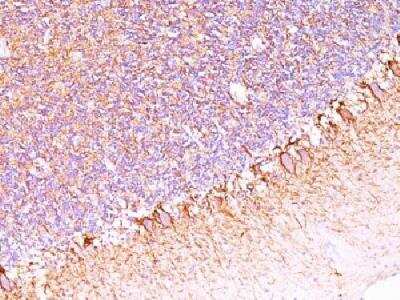Immunohistochemistry-Paraffin: NF-H Antibody (SPM563) [NBP2-34380]