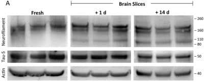 Western Blot: NF-H Antibody [NB300-135]