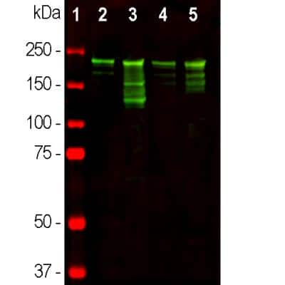 Western Blot: NF-H Antibody [NBP1-05215]