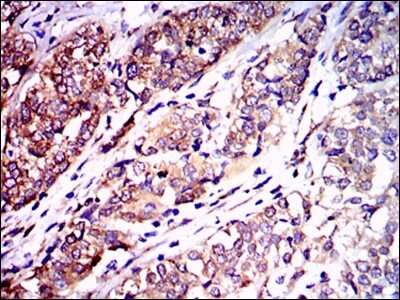 Immunohistochemistry-Paraffin: NF-L Antibody (1H3) - BSA Free [NBP2-37528]