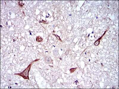 Immunohistochemistry-Paraffin: NF-L Antibody (2G10) - BSA Free [NBP2-37525]