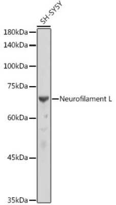 Western Blot: NF-L Antibody (3L9Y10)Azide and BSA Free [NBP3-15874]