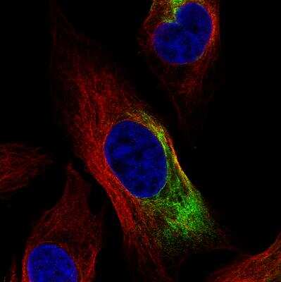 Immunocytochemistry/ Immunofluorescence: NF-L Antibody (CL4729) [NBP2-59061]