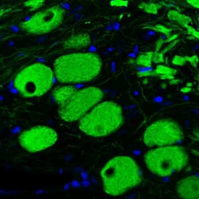 Immunohistochemistry: NF-L Antibody (CL4729) [NBP2-59061]